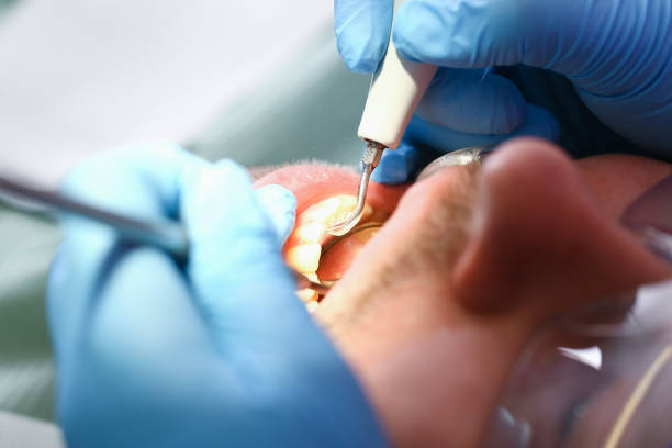 Best Broken or Cracked Tooth Emergency Dentist in Laurel Park, NC
