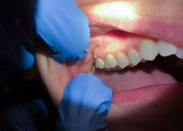 Best Weekend Emergency Dentist in Laurel Park, NC