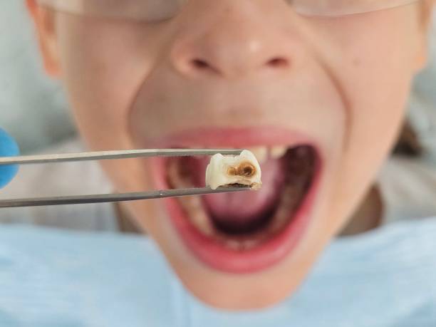 Best Pediatric Emergency Dentist in Laurel Park, NC